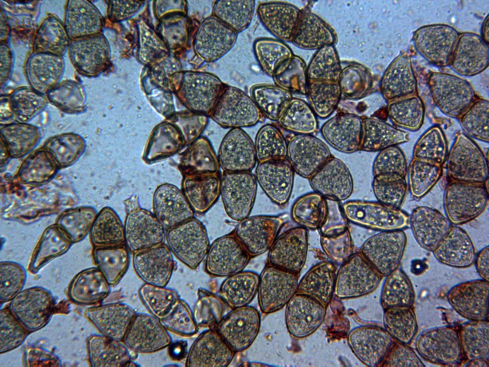 10 - Teliosporas x 400 rojo 2